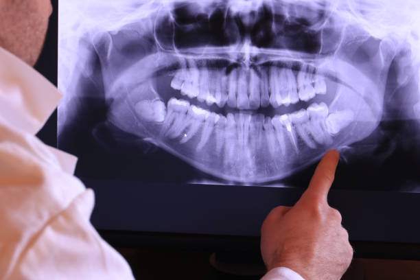 Best Broken Tooth Emergency  in Dyer, TN