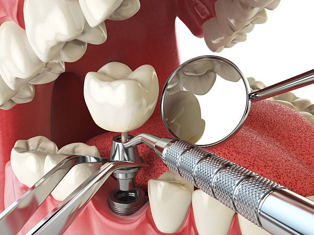 Best Urgent Tooth Repair  in Dyer, TN